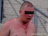 Ein verletzter Antifaschist in Pushkin 7