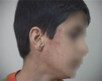 11 jährige Junge von Polizisten misshandelt