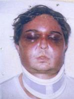Unai Romano, nachdem er aus den Folterkellern in ein Madrider Krankenhaus gebracht wurde.